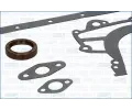 AJUSA Kompletn sada tsnn motoru AJS 51017000, 51017000