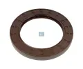 T�snic� krou�ek h��dele diferenci�lu&nbsp;DT&nbsp;&dash;&nbsp;DT 7.38220
