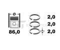 ET ENGINETEAM Sada pstnch krouk ETE R1006950, R1006950