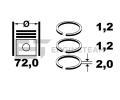 ET ENGINETEAM Sada pstnch krouk ETE R1009500, R1009500
