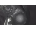 HAZET Videoendoskop-sada HZT 4812-23/5AF, 4812-23/5AF
