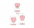TRW Sada brzdovch destiek COTEC ‐ TRW GDB1371