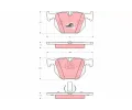 TRW Sada brzdov�ch desti�ek COTEC&nbsp;&dash;&nbsp;TRW GDB1499