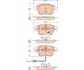 Sada brzdovch destiek TRW ‐ TRW GDB1762