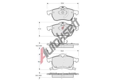 Starline Sada brzdovch destiek BD S081, 90544001